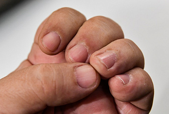 Ногти тоже стареют: как избавиться от желтизны, ломкости и других неприятностей