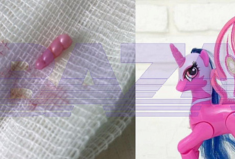 Семилетняя девочка два года прожила с рогом единорога во лбу