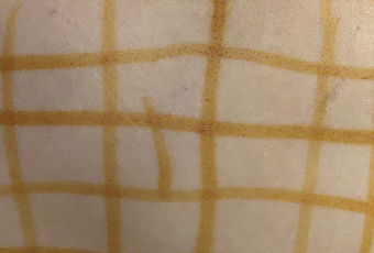 Как без анализов узнать, что в организме не хватает йода