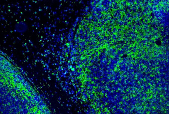 Ученые МГУ создали флуоресцентный зонд для ускорения разработки противораковых препаратов