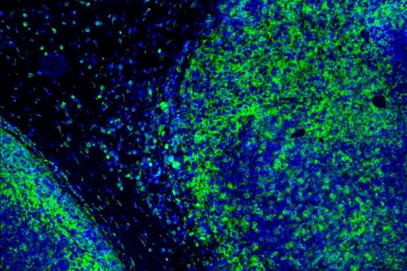 Ученые МГУ создали флуоресцентный зонд для ускорения разработки противораковых препаратов