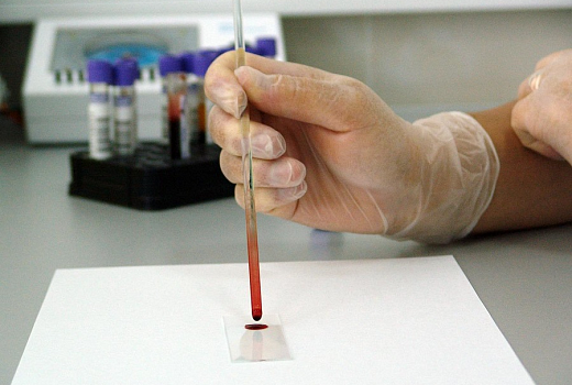 Железо и человек: что делать, если повышен гемоглобин