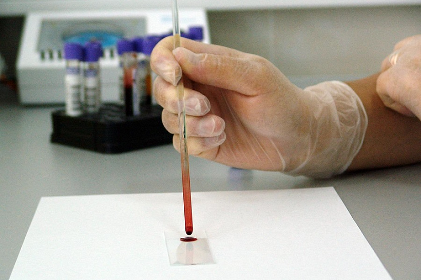 Железо и человек: что делать, если повышен гемоглобин