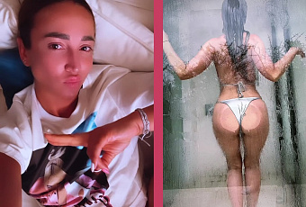 Совсем припухла: Ольга Бузова призналась, почему у нее без макияжа красные щеки и синий нос