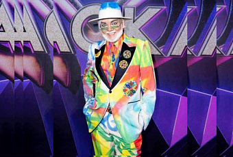 Количество пластических операций Филиппа Киркорова выдали две маленькие, аккуратно подбритые детали