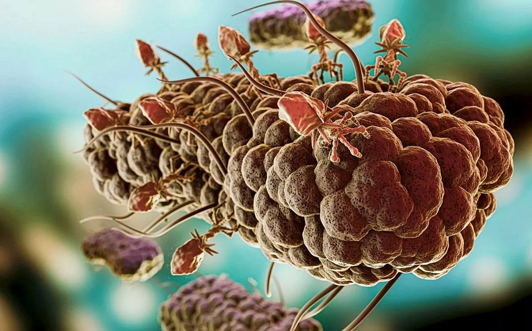 ФОМС будет ежегодно выделять 140 миллиардов рублей на лечение онкологии