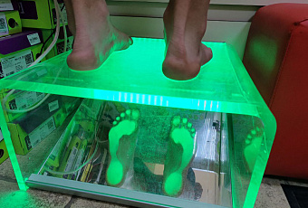 Летящей походкой: как предупредить плоскостопие и почему так важно его вовремя лечить