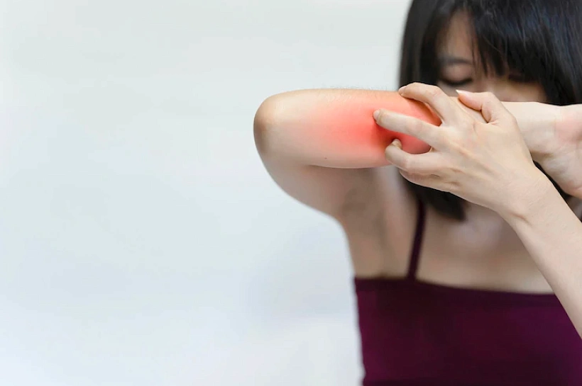 Какой цвет обладает значительным потенциалом, который поможет в битве против комаров