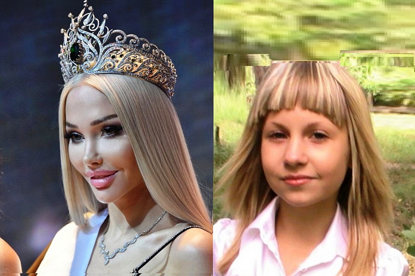 Блогеры требуют, чтобы «Мисс Москва 2023» отдала корону своему пластическому хирургу