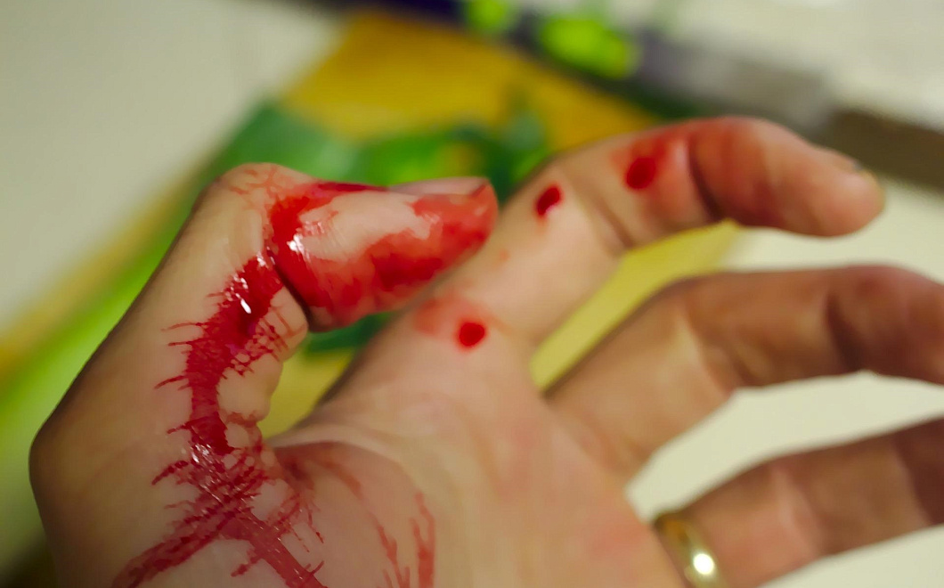 Какие домашние средства эффективны  при остановке крови