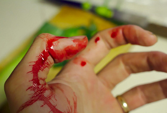 Какие домашние средства эффективны  при остановке крови