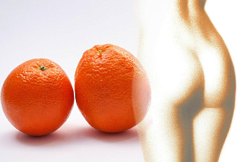 Целлюлит: коварный враг женщин или великая ложь нашего времени