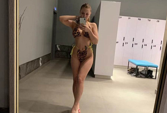 Невестка Наташи Королевой прикрыла дефект пятнистой тряпочкой