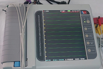 Городская больница №1 Сочи получила оборудование в рамках национального проекта