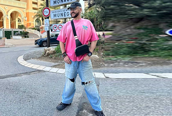 Филипп Киркоров пожаловался, что пластическим хирургам больше неоткуда брать кучеряшки для пересадки