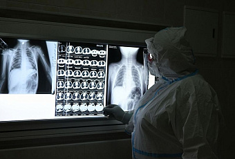 Рост продолжается: за сутки на Кубани выявили еще 524 случая заражения COVID-19